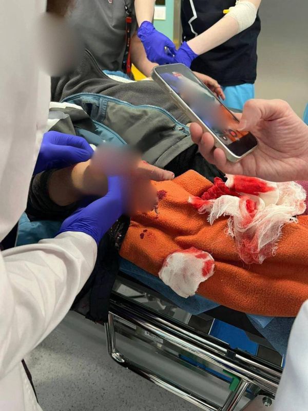 В подмосковном Красногорске 9-летнему мальчику оторвало пальцы, когда он поднял сверток с деньгами на улице