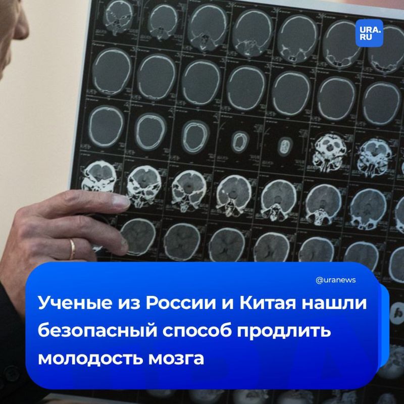 Продлить молодость мозга возможно