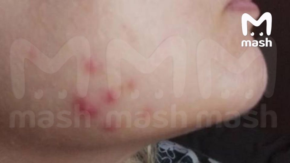 Поклонники расхайпленных липолитиков в лицо и тело — внимание, вы можете умереть