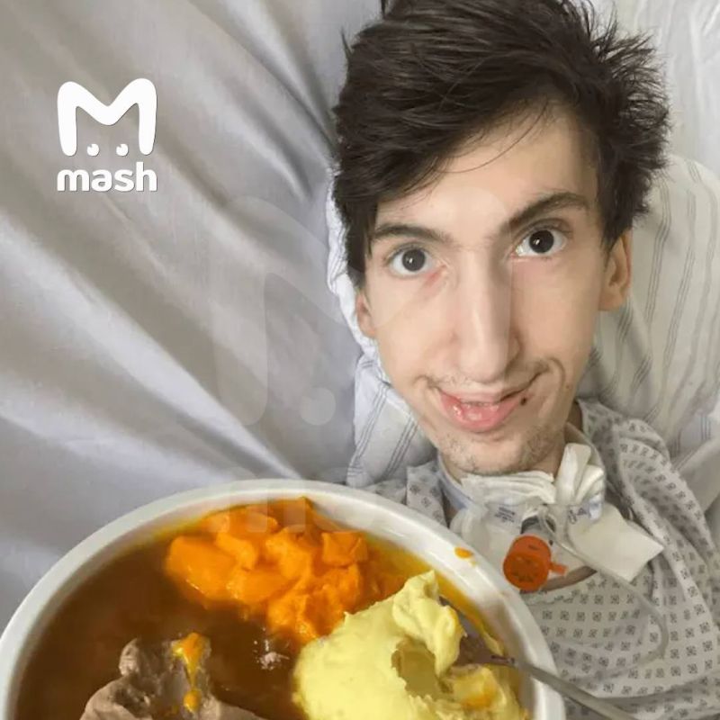 Российский турист с инвалидностью впал в кому в Германии из-за испорченного йогурта