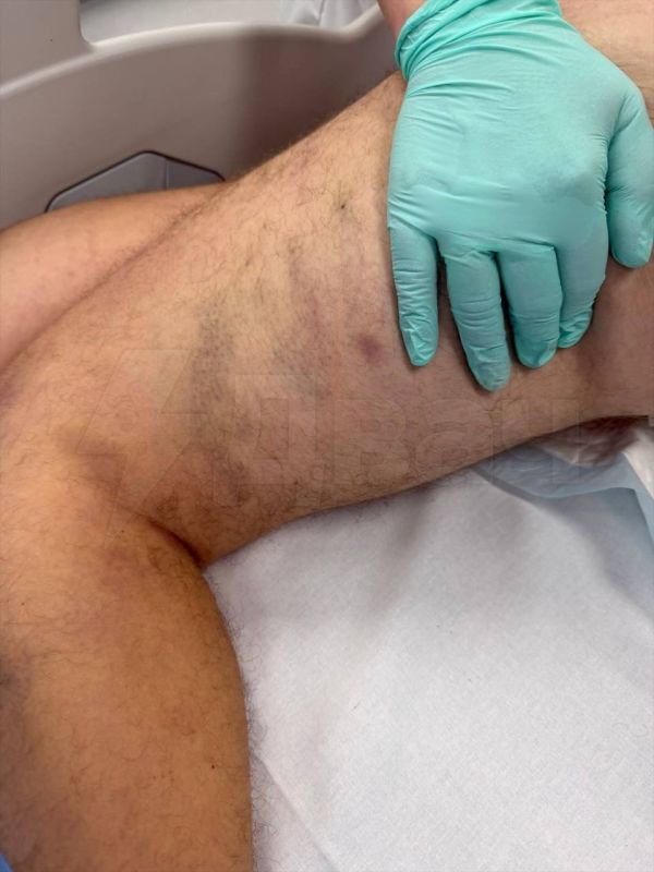 «Морили голодом и избивали»: подросток из элитного рехаба подмосковья на грани смерти после жестокого обращения «Морили голодом и избивали»: подросток из элитного рехаба подмосковья на грани смерти после жестокого обращения