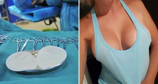 Сделать силиконовую грудь в России станет значительно дешевле
