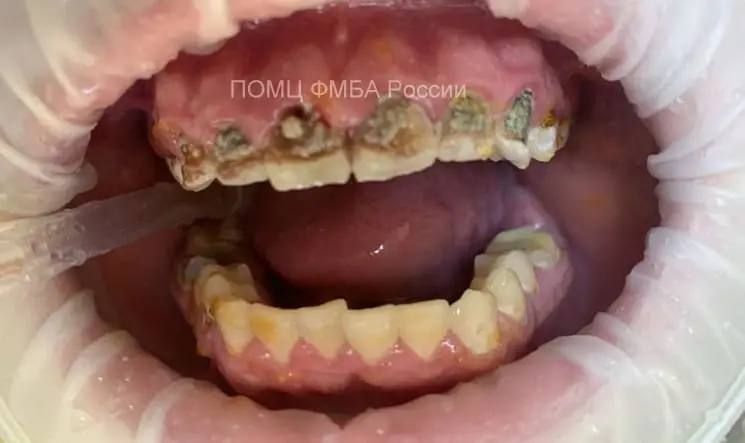 ��� ������ ��� ���������� � ��� �������� ��� �����