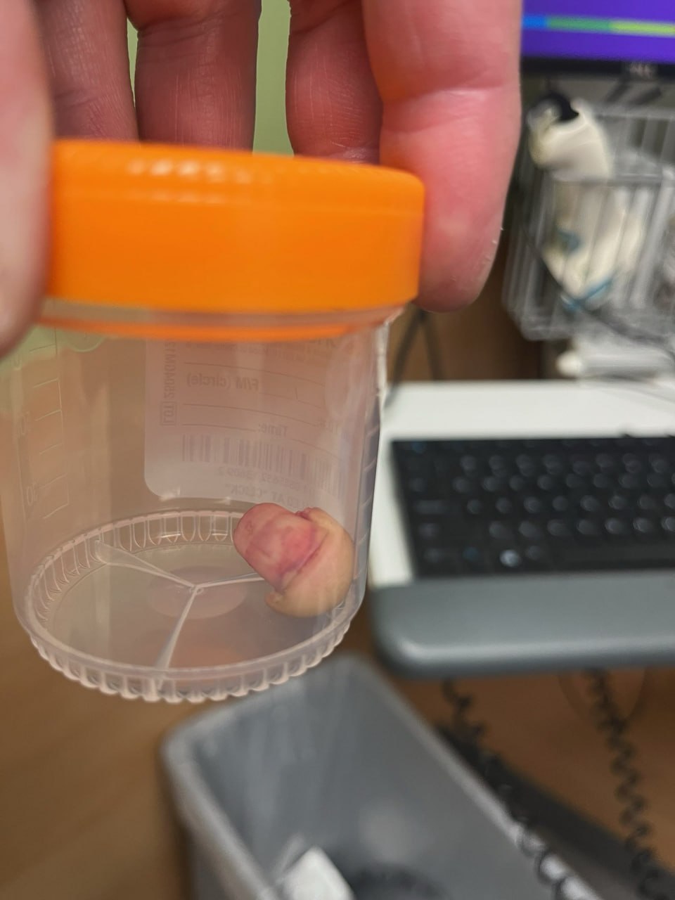 Один из участников беспорядков в Миннеаполисе начисто откусил палец сотруднику миграционного контроля Один из участников беспорядков в Миннеаполисе начисто откусил палец сотруднику миграционного контроля