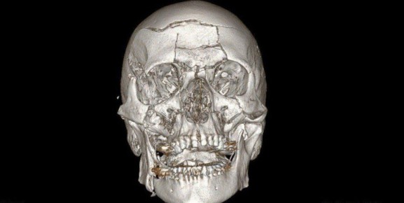 ����� "������� ����" �������� �� ��������� ������� � ���������, ������� �������� �����������