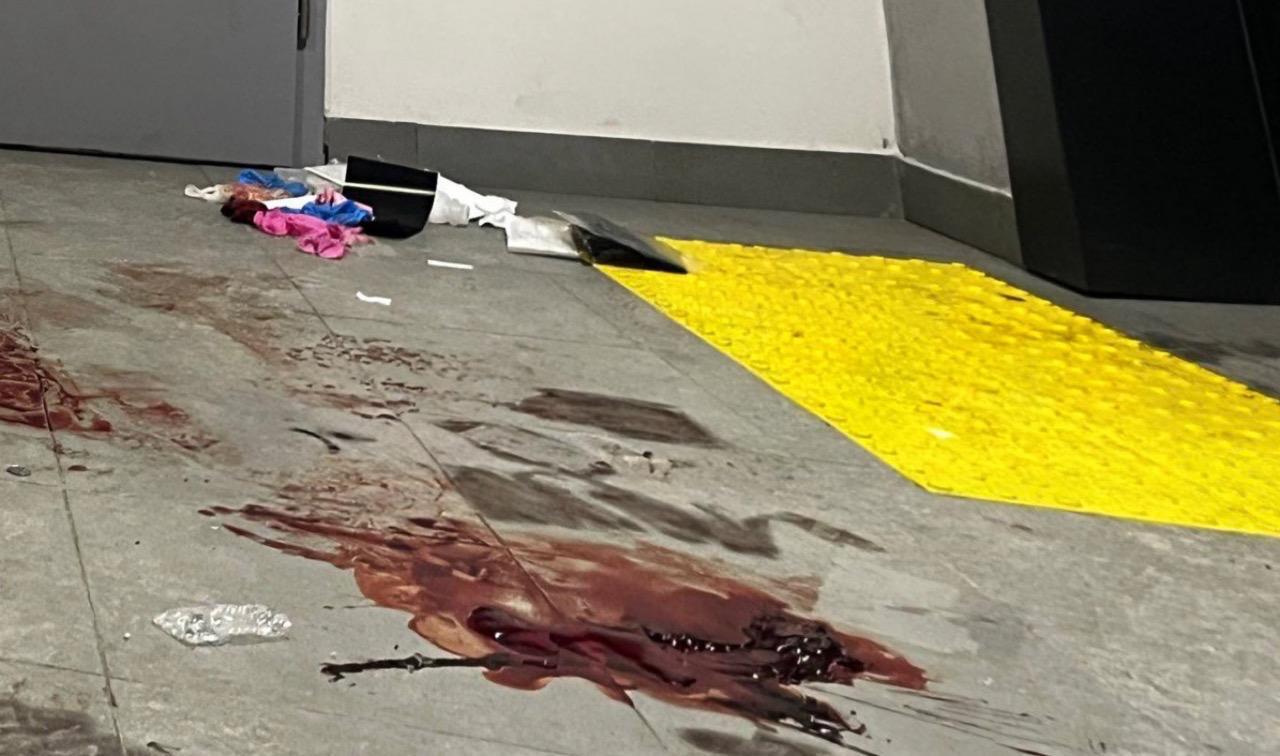 На грани. Поступают тяжелые подробности о состоянии генерал-лейтенанта Владимира Алексеева после покушения