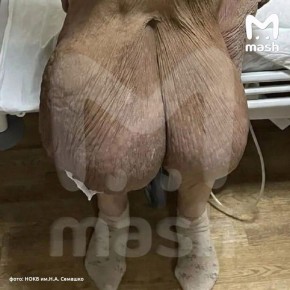 ���������� ����������� �� ������ �������� � ���������� ������������� ������� � ������ ���� ��� � �� ����� �������������� ��������� �����