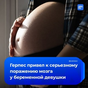 «Герпес уничтожил мозг беременной»: молодая пациентка перенесла герпетический энцефалит