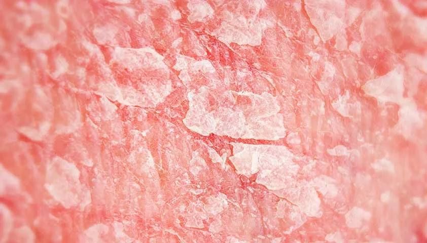 ������������ ��������� �������;