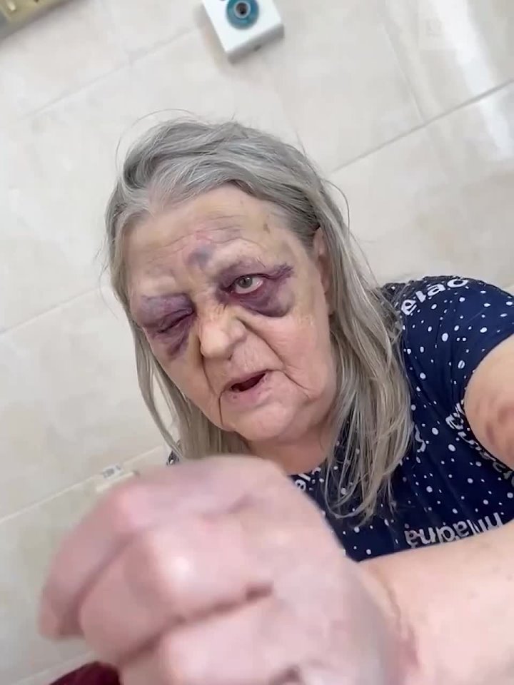 76-летнюю пенсионерку избили в больнице города Мариинска в Кемеровской области