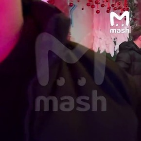 Победительницу конкурсов красоты избили и изуродовали ей лицо после концерта группы "Тату" в клубе пятизвёздочного отеля в Казани