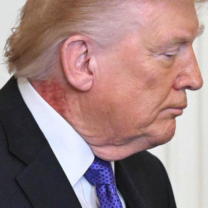 Трамп смертельно болен: так снова считают американские СМИ